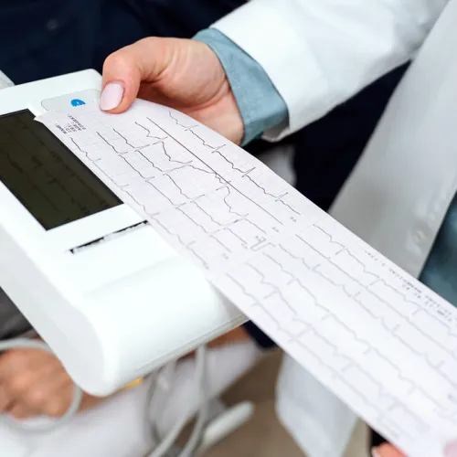 Healthcare worker holding a portable EKG device printing a heart rhythm strip, with patient lying in background and wires attached